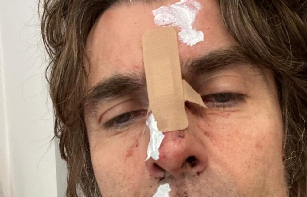 liam gallagher